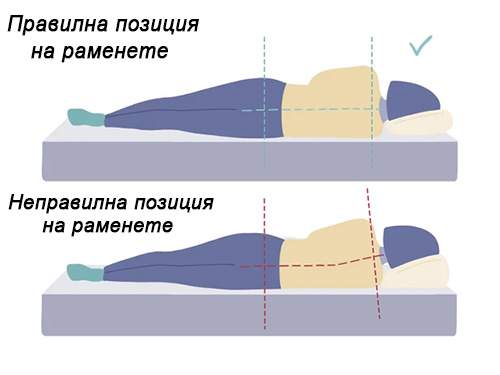 Матраци с мемори пяна - позиция на раменете